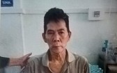 姜凱姜要隨身攜帶尿袋。
