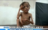 聯合國警告封鎖使也門面臨大饑荒。（圖源：CCTV視頻截圖）