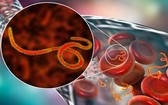 埃博拉病毒最早是在1976年被發現。此病毒可直接傳染給人。 （圖源：Shutterstock）