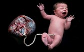 孕產婦在家順產自然分娩一直以來發生了不少母嬰死亡的悲慘案例。（示意圖源：田升）