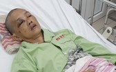 王琪玉正在阮知方醫院治療。