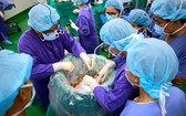 手術團隊為患者進行肺部移植。（圖源：院方提供）