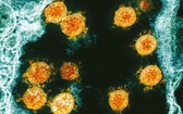 日本京都府立醫科大學研究小組日前公佈一項研究成果，稱新冠病毒一旦附著人體皮膚，其傳染性可至少持續9個小時。（圖源：AP）