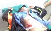 傷者及時獲送醫院急救,傷勢較為嚴重。(圖源:VNN)