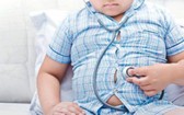 肥胖症兒童可導致代謝紊亂，引發多種疾病影響生活質量。