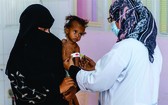 一歲多女孩在也門一家醫院接受營養不良治療。（圖：互聯網）