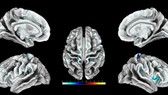 Vỏ não somatosensory phát triển tốt hơn ở những phụ nữ có tần suất quan hệ tình dục cao. Ảnh: AFP.