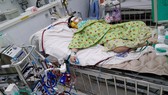 Đặt ECMO cho bệnh nhi N.V.M.Q. Ảnh: BVCC