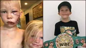 Cậu bé Briger Walker cứu em gái khỏi chó dữ và đai vô địch WBC hạng cân "Bridger"