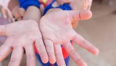 Bệnh tay chân miệng tăng 4,4 lần so với cùng kỳ tại Vĩnh Long