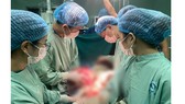 Quảng Ngãi: Phẫu thuật thành công khối u xơ nặng 5kg ở phụ nữ 47 tuổi