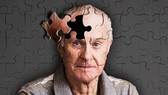 Dự án phát hiện sớm bệnh Alzheimer