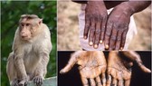 Người dân cần chủ động khai báo khi nghi mắc bệnh đậu mùa khỉ