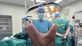 Cắt bỏ thành công khối u khổng lồ nặng 9kg trên lưng một chàng trai