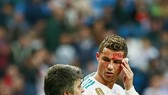 Ronaldo đổ máu vì dính gầm giày đối phương. Ảnh: Getty Images