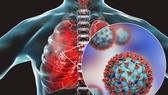 SARS-CoV-2 phá hủy đáng kể hệ thống miễn dịch của bệnh nhân ung thư chưa tiêm phòng