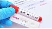Có thể xác định mắc Covid-19 qua triệu chứng bệnh, dù kết quả xét nghiệm PCR âm tính