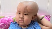 Bé trai bị u não ác tính