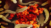 Biến thể D614G được tìm thấy trong 4 ca nhiễm virus SARS-CoV-2 tại 2 cụm dịch của Malaysia. Ảnh: Bloomberg