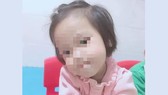 Bé gái 3 tuổi bị người tình của mẹ đóng 9 chiếc đinh vào đầu đã tử vong