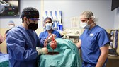 Các bác sĩ tiến hành ca phẫu thuật ghép tim heo cho bệnh nhân tại Baltimore, bang Maryland, Mỹ ngày 7-1-2022. Ảnh: AFP/TTXVN