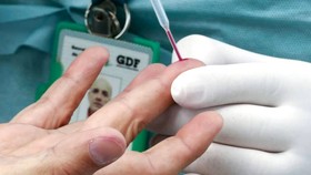 Tiết kiệm vaccine Covid-19... kiểu Pháp