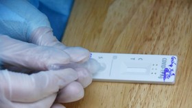 Xử nghiêm tham nhũng, tiêu cực trong mua sắm hoá chất, sinh phẩm chống dịch