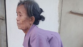 Cụ bà neo đơn mang 2 khối u khổng lồ