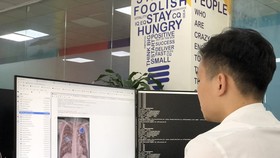 Chuyên gia AI của VinBrain đang sử dụng NVIDIA DGX A100 để đào tạo mô hình AI chẩn đoán bệnh lao