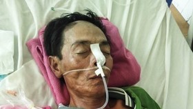 Anh Nguyễn Văn Công bị liệt nửa người, phải sống đời thực vật