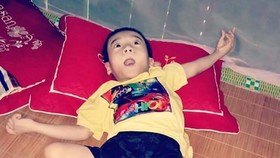 Tay chân cháu An ngày càng teo tóp, nằm liệt một chỗ, nói cười vô thức