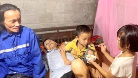 Bố suy thận giai đoạn cuối, con sứt môi, hở hàm ếch