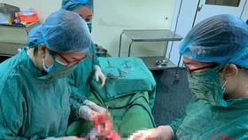 Vietnamese doctors conduct surgery on woman with two wombs carrying twin in each