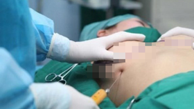 Vụ thai phụ tử vong sau khi nâng ngực: Bác sĩ phẫu thuật làm đúng!