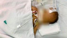 Bé trai đang được điều trị tích cự tại Bệnh viện quận Thủ Đức