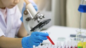 Công nghệ chỉnh sửa gene CRISPR tiên tiến mở ra hy vọng điều trị bệnh bạch cầu