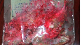 Mẫu cá bạc má có màu hồng đỏ thời điểm gửi ra Viện Kiểm nghiệm ATVSTP Quốc gia để xét nghiệm