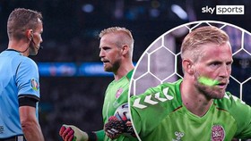 Tia laser chiếu vào mặt thủ thành Kasper Schmeichel.