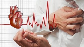 Bộ Y tế khẳng định không có virus viêm cơ tim