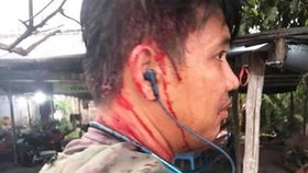 Một thanh niên bị chủ quán hành hung sau khi vào một quán ăn ở xã Nhựt Chánh, huyện Bến Lức (Long An) 