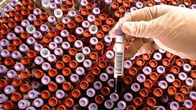 Trung Quốc điều tra vụ hơn 12.000 chai huyết tương nhiễm HIV