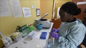 Nhân viên y tế làm việc tại phòng thí nghiệm tại Viện kiểm soát và nghiên cứu bệnh cúm Lassa ở Irrua, bang Edo, Nigeria. Ảnh: TTXVN