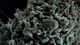 Hình ảnh dưới kính hiển vi một tế bào (màu xanh) của bệnh nhân Covid-19 bị nhiễm biến thể B.1.1.7 của virus SARS-CoV-2 (màu vàng). Ảnh: AFP/TTXVN