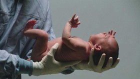 Nghiên cứu mới hỗ trợ điều trị tổn thương não ở trẻ sơ sinh