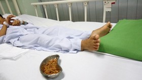 Bé trai 11 tuổi bị tắc hậu môn do nuốt hơn 70 gram hạt sơ ri