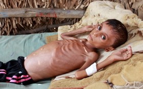 圖為也門一名飽受饑荒煎熬、瘦到皮包骨的少年。（圖源：互聯網）