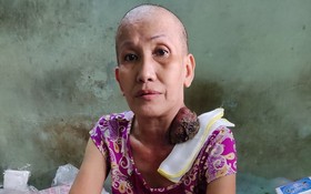吳玉鳳接受化療後，腫瘤開始變小了。