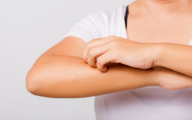 注意加強預防皮膚癌“元兇”措施