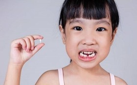 兒童換牙期間要注意事項