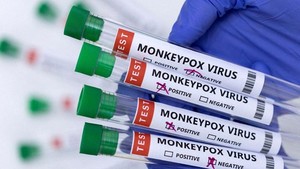 Vietnam to import vaccines and drugs to treat monkeypox
